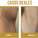 Blancoderma - Crema blanqueadora 100% Natural