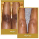 Blancoderma - Crema blanqueadora 100% Natural