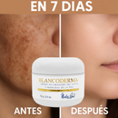 Blancoderma - Crema blanqueadora 100% Natural